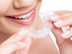 ホームホワイトニング用マウスピースをはめようとしてる女性